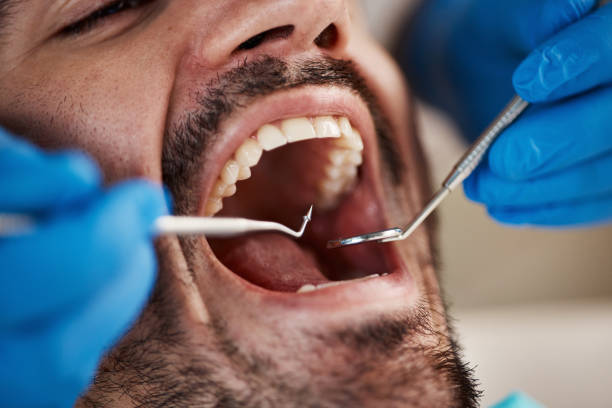 Best Emergency Wisdom Teeth Removal in Walthourville, GA